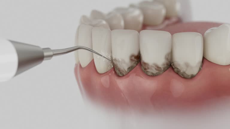 Reliable Emergency Dentist contractor in Corralitos, CA by Smile Center Dentistry